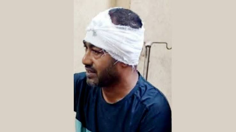 জাসদের সাবেক মেয়রের ওপর হামলা, মাথায় ১১ সেলাই