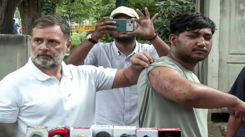 নিরাপত্তা বাহিনীর ছররা গুলি, কার নির্দেশে অভিযান—জোরালো প্রশ্ন